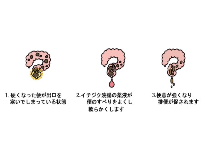 イチジク浣腸の効果