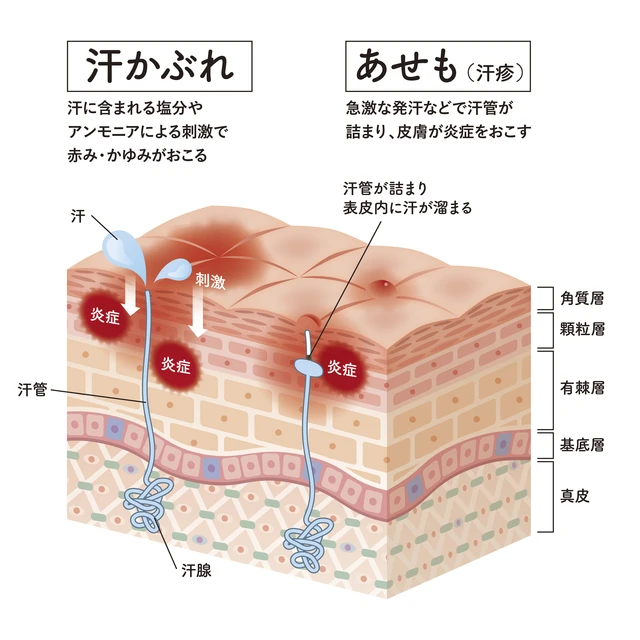 あせも、肌かぶれと肌の構造