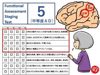 画像1.jpg 認知症 中等度