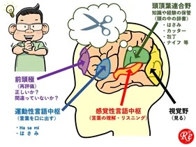 nts-5-2.jpg 認知症 脳内